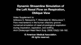 Dynamic Streamline Simulation of Nasal Flow Part 2 [upl. by Maida693]