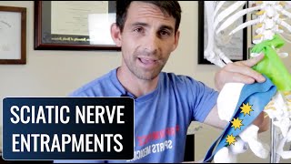 Sciatic Nerve Entrapment Sites Which Do You Have EASY TO FOLLOW [upl. by Brien346]