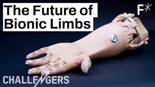 3D printed mindcontrolled prosthetics are here  Challengers by Freethink [upl. by Amer949]