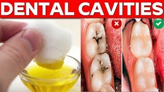 How To Cure Teeth Cavities Naturally at Home  Get Rid of Dental Cavities In 2 Days [upl. by Heathcote]