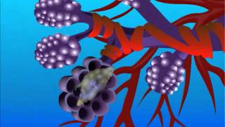 Aspergillosis – Type of Fungal Infection [upl. by Aicyla797]