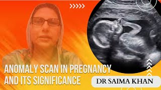 Anomaly scan in pregnancy and its significance  Dr Saima Khan [upl. by Jonna439]