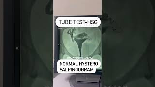 HSG  Tube patency test infertility biology medico pregnancy motherhood baby motivation [upl. by Niret777]