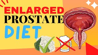 ENLARGED PROSTATE DIET ADVICE  FOODS TO EAT AND FOODS TO AVOID [upl. by Ynnot]