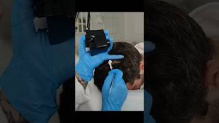 Scalp examination for sensitive skin areas [upl. by Severson]