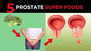 You dont know the 5 incredible super foods that shrink the prostate [upl. by Ramyar]