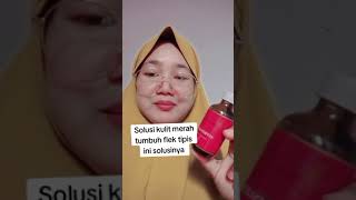 Video 6 Clariderm original mengatasi kulit merah caranya seperti ini ya skincare skincareroutine [upl. by Ellitnahc]