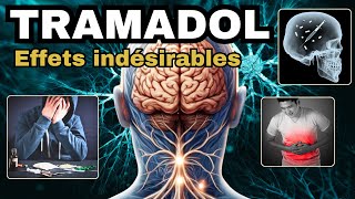 TRAMADOL et ses EFFETS INDESIRABLES à connaître [upl. by Sevein544]