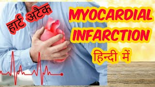 Myocardial infarction in hindi Part 2 [upl. by Goeger]