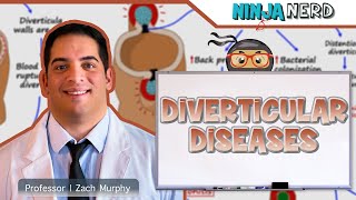 Diverticular Diseases  Clinical Medicine [upl. by Einhapets]