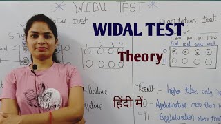 Widal Test  Widal Test For Typhoid  Typhoid test in hindi  Typhoid disease test  विडाल टेस्ट [upl. by Siravaj]