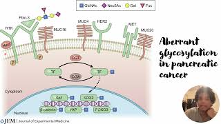 Aberrant Glycosylation in pancreatic cancer Code 343 [upl. by Asoramla]