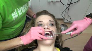 Nice Teeth Bro Removal of Braces [upl. by Munshi641]