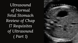 Normal Fetal Stomach Ultrasound Pregnancy Ultrasound Guide  Review from Requisites of Ultrasound [upl. by Dazraf258]