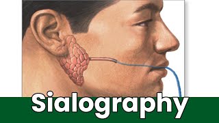 What Is Sialography Overview Uses And The Procedure How Is Sialography Done [upl. by Anitrebla]