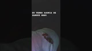 Minha ferida tá sangrando [upl. by Heer]