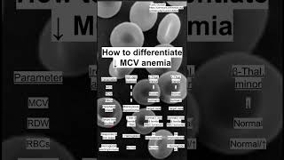 How to differentiate ↓ MCV anemia [upl. by Norby762]