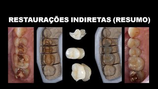 RESTAURAÇÕES INDIRETAS RESUMO [upl. by Okir]