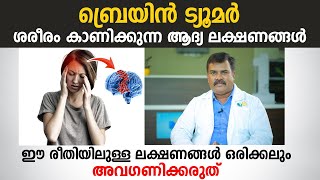 ബ്രെയിൻ ട്യൂമർ ശരീരം കാണിക്കുന്ന ആദ്യ ലക്ഷണങ്ങൾ ഇവയാണ്  Brain Tumor Symptoms  Arogyam [upl. by Drarehs]