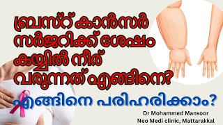 ബ്രസ്റ് കാൻസർ സർജറിക്ക് ശേഷം കയ്യിൽ ഉണ്ടാകുന്ന നീർLymphedema പരിഹാരം അറിയൂ [upl. by Yelad]