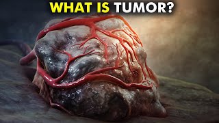 How Tumors are formed Types of Tumors 3d animation [upl. by Kuska]