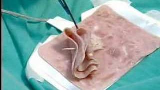 Endoscopia quotLa Historia no Contadaquot parte 6 67 [upl. by Duaner]