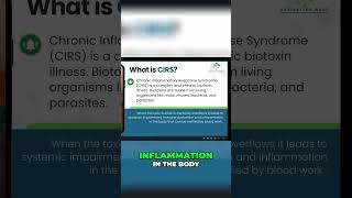 Understanding CIRS Uncovering Chronic Inflammatory Response Syndrome [upl. by Olcott18]