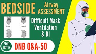 BEDSIDE Airway ASSESSMENT  Predictors of DIFFICULT Mask VENTILATION  INTUBATION  LARYNGOSCOPY [upl. by Niwde]