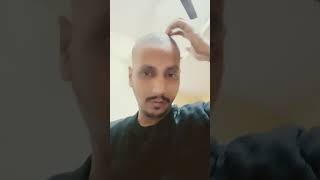 jaborandi hair oil ytshorts viral funny [upl. by Nirtiak502]