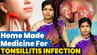 Tonsils Home Remedy  டான்சில்ஸ் பிரச்சனையை மாத்தறை இல்லாமல் குணப்படுத்த எளிய வழி  Dr Yoga vidhya [upl. by Elana886]