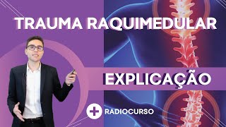 Entenda Sobre Trauma Raquimedular [upl. by Hibben833]