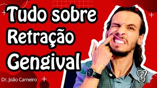 Retração gengival  o que fazer [upl. by Zerla]