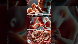 How Babies Move in the Womb Single Twins and Triplets Explained  Multiple Pregnancy shorts life [upl. by Nwhas]