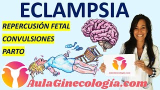 ECLAMPSIA PATOGÉNESIS CLÍNICA MEDIDAS GENERALES TRATAMIENTO PARTO Ginecología y Obstetricia [upl. by Anole]