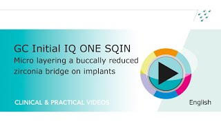 GC Initial IQ ONE SQIN Micro layering a buccally reduced zirconia bridge on implants [upl. by Shields]