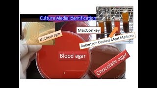 Culture media the simplest way of identification  Blood MacConkey  Chocolate RCM Nurient agar [upl. by Nico]