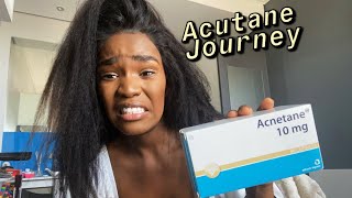 My ACCUTANE journey  first week  side effects [upl. by Artap]