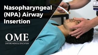 Nasopharyngeal Airway NPA Insertion [upl. by Malti]