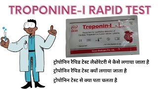 TroponinI Test  Cardiac Troponin I [upl. by Caraviello]