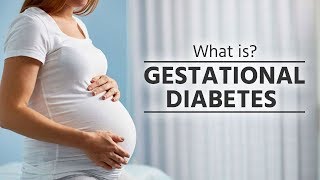 What is gestational diabetes   what causes gestational diabetes  Preventing Gestational Diabetes [upl. by Cher841]