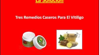 Tratamientos Caseros Para El Vitiligo  Remedios Caseos Altenativos [upl. by Elleinwad]