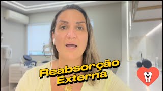 SERÁ QUE UMA REABSORÇÃO EXTERNA É RESOLVIDA TRATANDO O CANAL  Endolovers [upl. by Garth145]