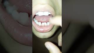 Primeiro dentinho dela [upl. by Aiet]