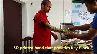 3d Print hand  3d Prosthesis artificial hand in Nepal [upl. by Aneram]