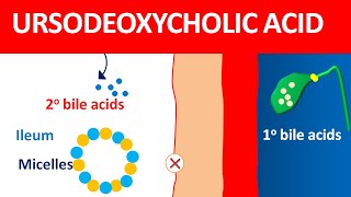 Ursodeoxycholic acid udca for biliary cirrhosis and gallstones [upl. by Monique938]