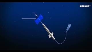 Unolok Infusion Set – Enables smooth IV infusion of medication [upl. by Arnelle505]