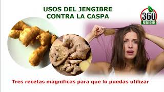 Remedios Caseros De Jengibre Para La Caspa Jengibre Para El Cabello [upl. by Nonez]