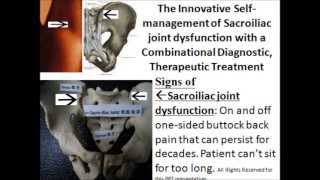 The Sacroiliac Joint Dysfunction Cure with an Innovative and Safe Home Treatment 1 [upl. by Loleta]