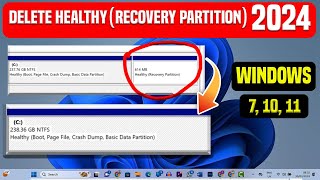 How To Delete Healthy  Recovery Partition Windows 10 11  7 delete recovery partition in windows [upl. by Hibbert]