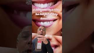 Whitening Teeth with Hydrogen Peroxide Fast Simple amp Easy  In Office to Hands On Dental Training [upl. by Spears]